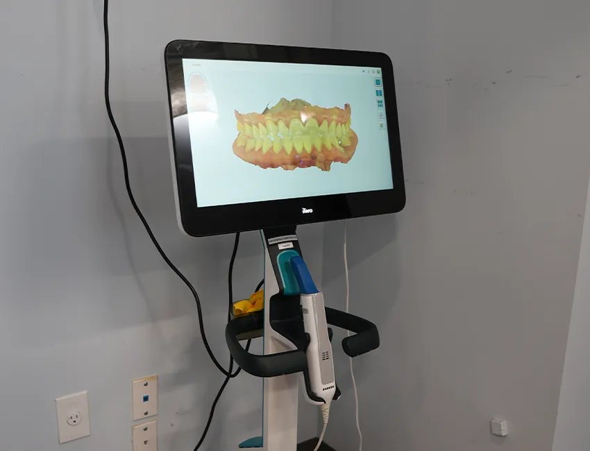 iTero digital scanner at Valencia Emergency Dentist
